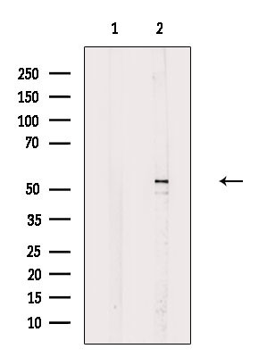 Phospho-MST2 (Ser316) Antibody in Western Blot (WB)