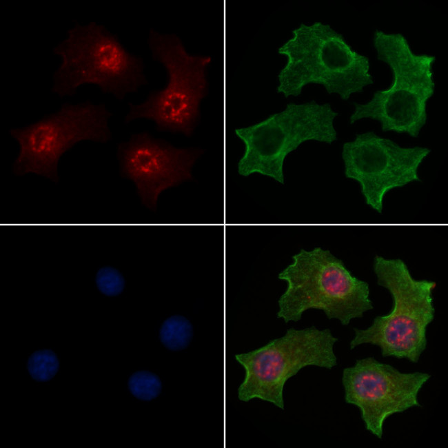 Phospho-WWTR1 (Ser66) Antibody in Immunocytochemistry (ICC/IF)