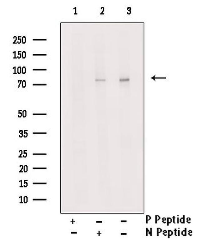 Phospho-SLP76 (Tyr173) Antibody in Western Blot (WB)
