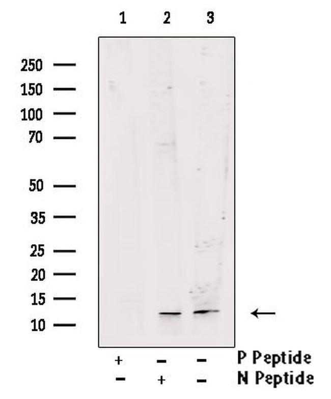 Phospho-ROC1 (Thr9) Antibody in Western Blot (WB)