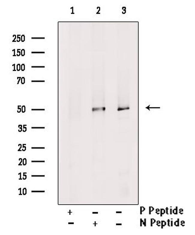 Phospho-PPAR delta (Thr256) Antibody in Western Blot (WB)