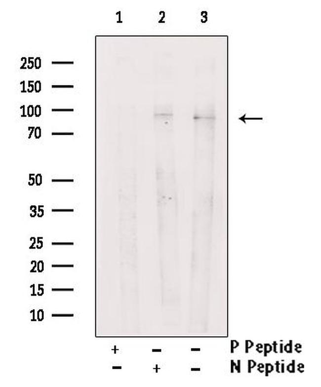 Phospho-PCAF (Tyr729) Antibody in Western Blot (WB)