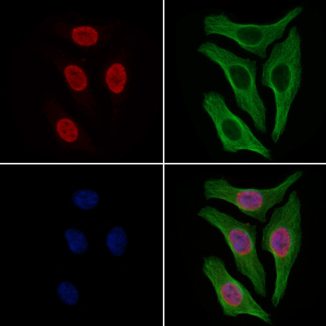 Phospho-NCF2 (Thr223) Antibody in Immunocytochemistry (ICC/IF)