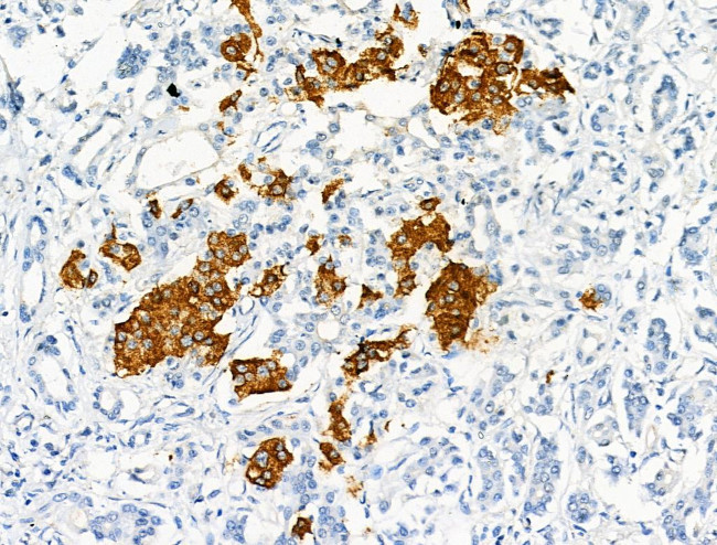 Phospho-CD79b (Tyr207) Antibody in Immunohistochemistry (Paraffin) (IHC (P))