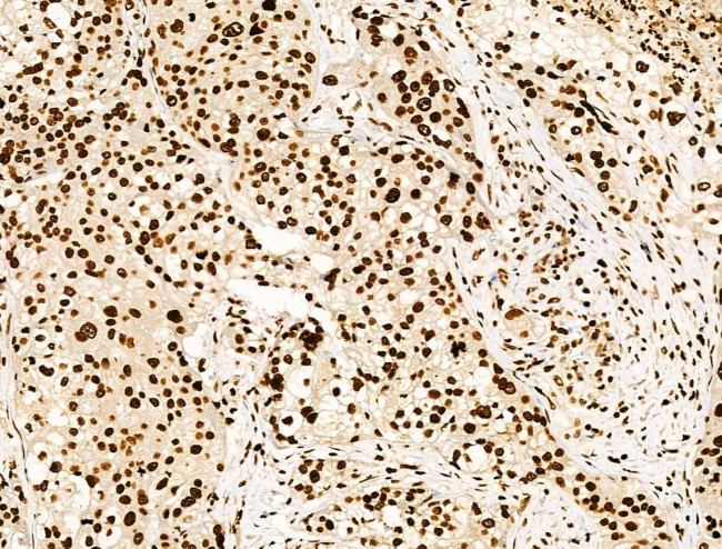 H4K91ac Antibody in Immunohistochemistry (Paraffin) (IHC (P))