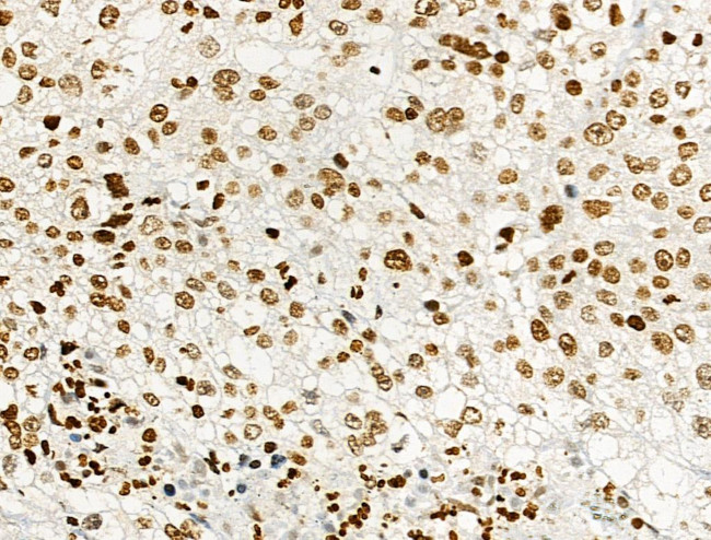 Phospho-Histone H2B (Tyr43) Antibody in Immunohistochemistry (Paraffin) (IHC (P))
