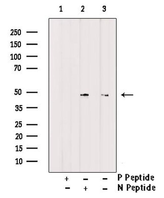 Phospho-eIF4A2 (Tyr49) Antibody in Western Blot (WB)