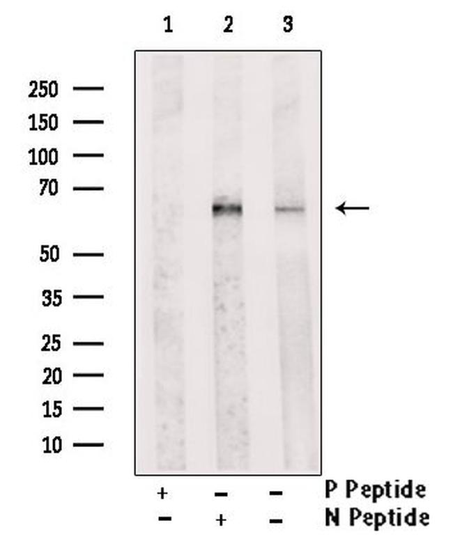 Phospho-IRAK2 (Tyr6) Antibody in Western Blot (WB)