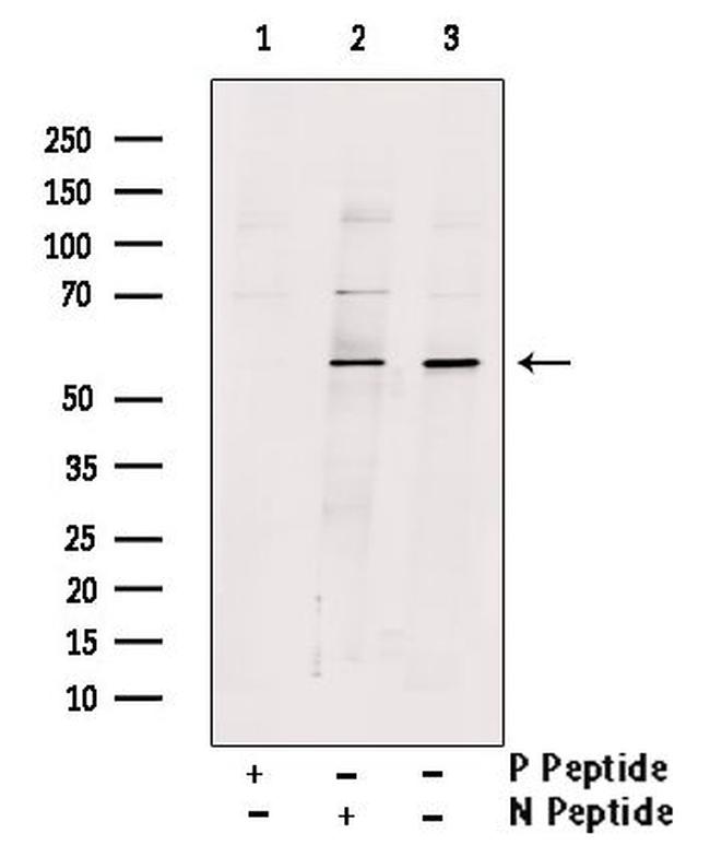 Phospho-DOK2 (Tyr345) Antibody in Western Blot (WB)
