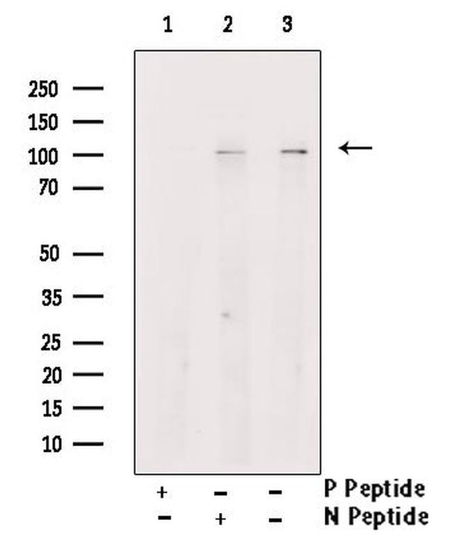 Phospho-CSF1R (Tyr699) Antibody in Western Blot (WB)