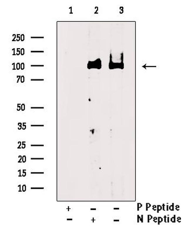 Phospho-CSF1R (Tyr923) Antibody in Western Blot (WB)
