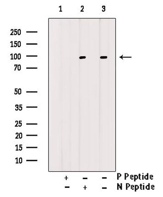 Phospho-IR/IGF1R (Tyr1161) Antibody in Western Blot (WB)