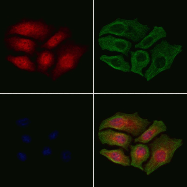 Phospho-Ku70 (Ser520) Antibody in Immunocytochemistry (ICC/IF)