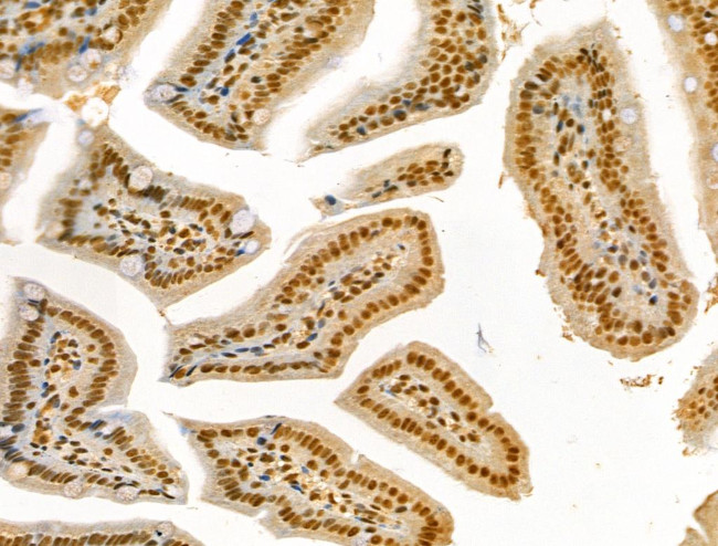 Phospho-Cyclin E (Thr73) Antibody in Immunohistochemistry (Paraffin) (IHC (P))