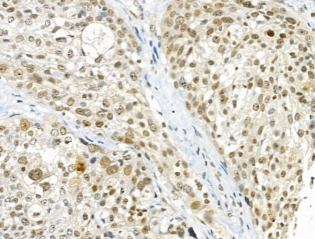 Phospho-cdc25C (Ser198) Antibody in Immunohistochemistry (Paraffin) (IHC (P))