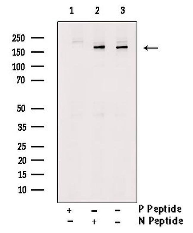 Phospho-IRS1 (Ser323) Antibody in Western Blot (WB)