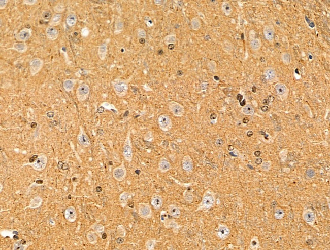 Phospho-VEGF Receptor 2 (Tyr1175) Antibody in Immunohistochemistry (Paraffin) (IHC (P))