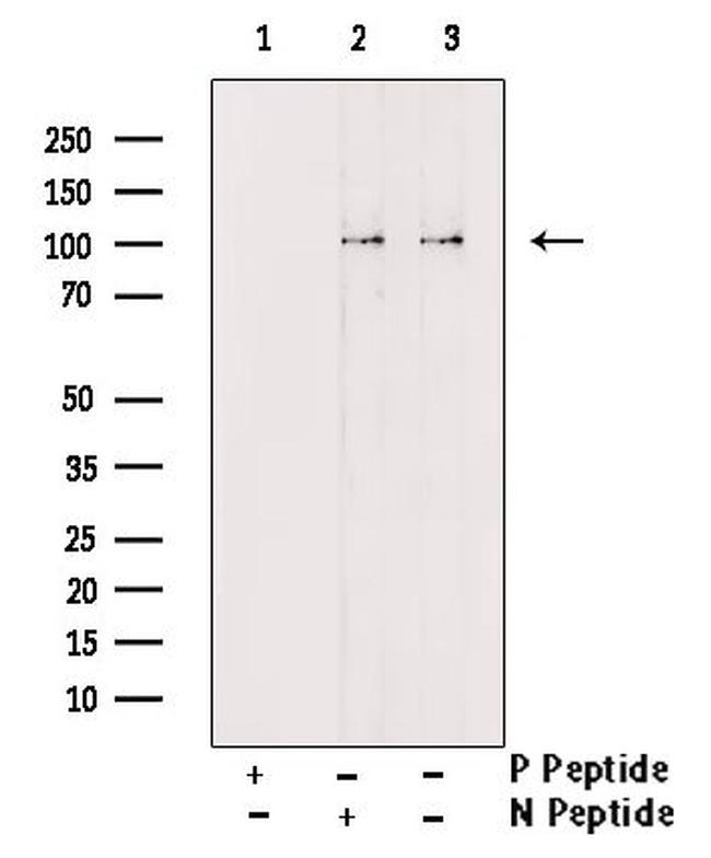Phospho-GluR1 (Ser849) Antibody in Western Blot (WB)