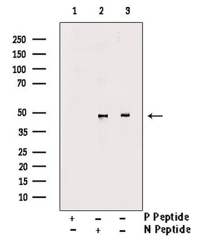 Phospho-MAP2K4 (Ser257) Antibody in Western Blot (WB)