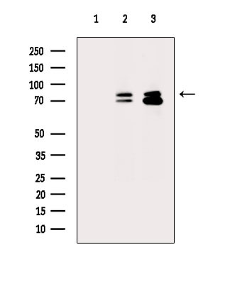 Phospho-NUMB (Ser276) Antibody in Western Blot (WB)