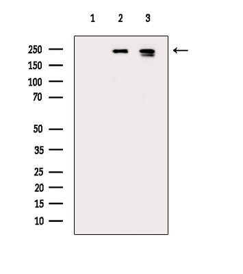 Phospho-TSC2 (Ser664) Antibody in Western Blot (WB)