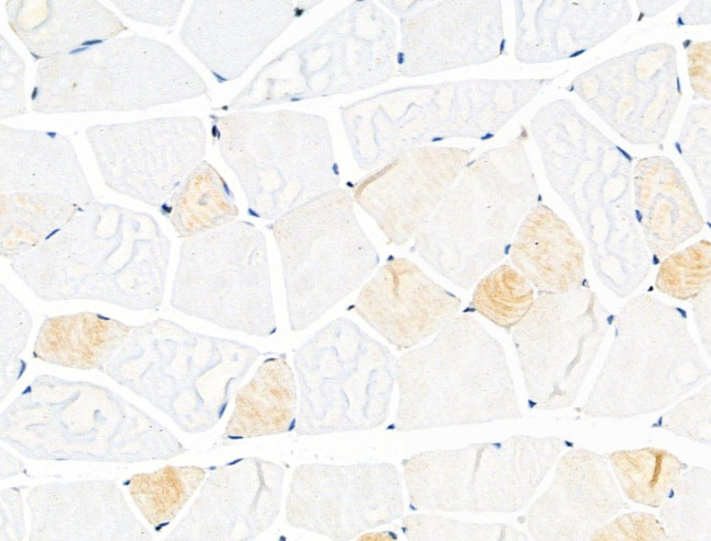 Phospho-KIF11 (Thr926) Antibody in Immunohistochemistry (Paraffin) (IHC (P))