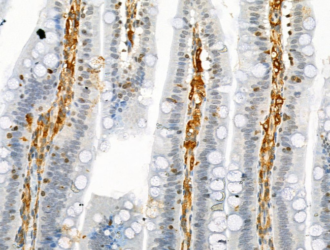 Phospho-PLCB3 (Ser537) Antibody in Immunohistochemistry (Paraffin) (IHC (P))