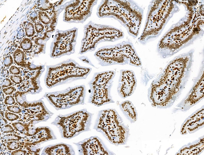 Phospho-MCL-1 (Ser64) Antibody in Immunohistochemistry (Paraffin) (IHC (P))