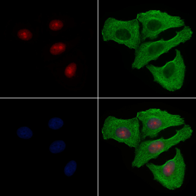 Phospho-53BP1 (Ser1618) Antibody in Immunocytochemistry (ICC/IF)