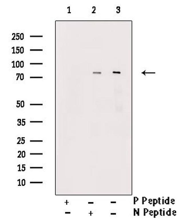 Phospho-SLP76 (Tyr145) Antibody in Western Blot (WB)