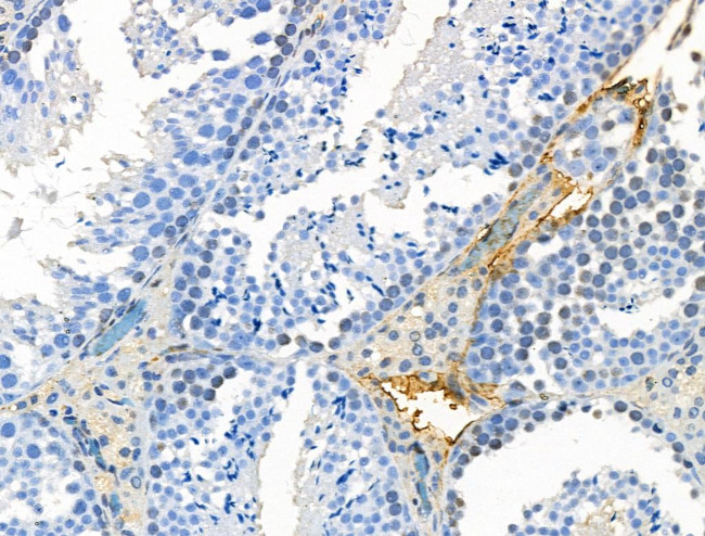 Phospho-CD226 (Ser329) Antibody in Immunohistochemistry (Paraffin) (IHC (P))