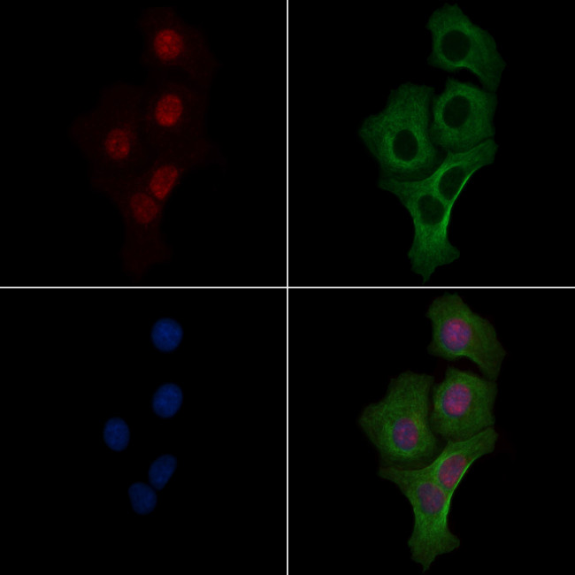 Phospho-DBC1 (Thr454) Antibody in Immunocytochemistry (ICC/IF)