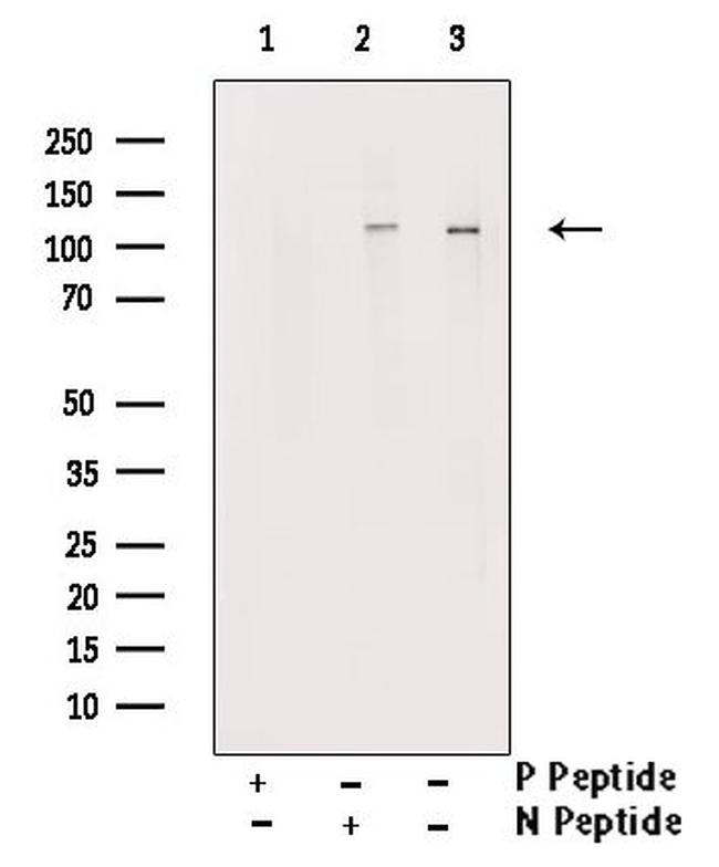 Phospho-SIRT1 (Ser27) Antibody in Western Blot (WB)