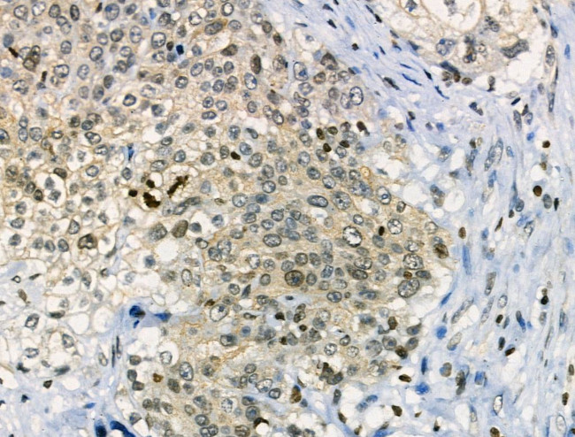 Phospho-CAMKK2 (Ser511) Antibody in Immunohistochemistry (Paraffin) (IHC (P))