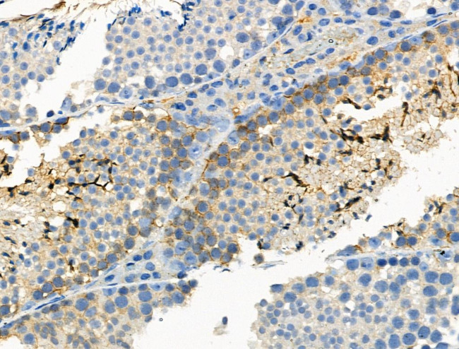 Phospho-ALK (Tyr1096) Antibody in Immunohistochemistry (Paraffin) (IHC (P))