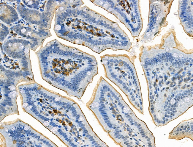 Phospho-ALK (Tyr1282, Tyr1283) Antibody in Immunohistochemistry (Paraffin) (IHC (P))