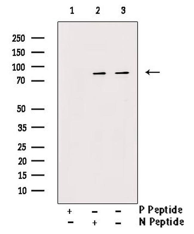 Phospho-RPH3A (Ser424) Antibody in Western Blot (WB)