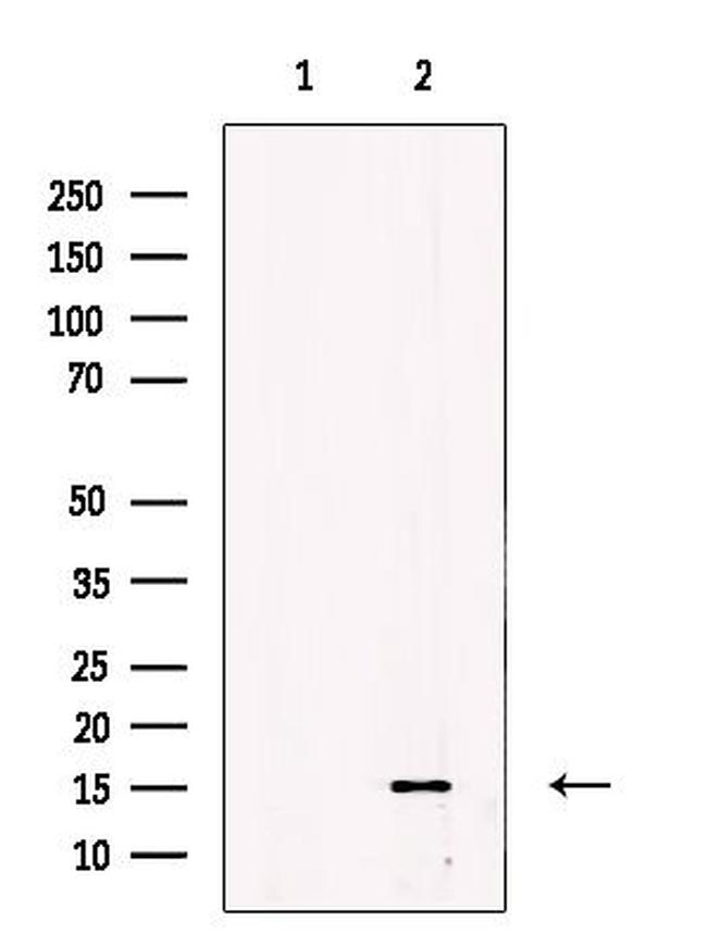 ENSA Antibody in Western Blot (WB)
