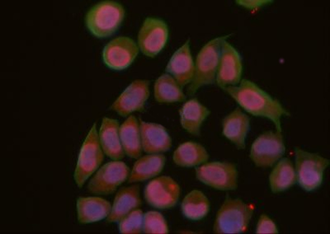 Rad52 Antibody in Immunocytochemistry (ICC/IF)