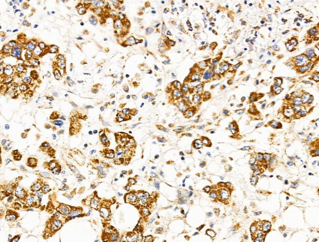 Caspase 4 Precursor (Cleaved Gln81) Antibody in Immunohistochemistry (Paraffin) (IHC (P))