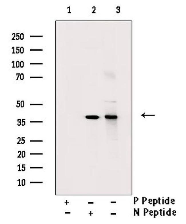Phospho-Cyclin H (Thr315) Antibody in Western Blot (WB)