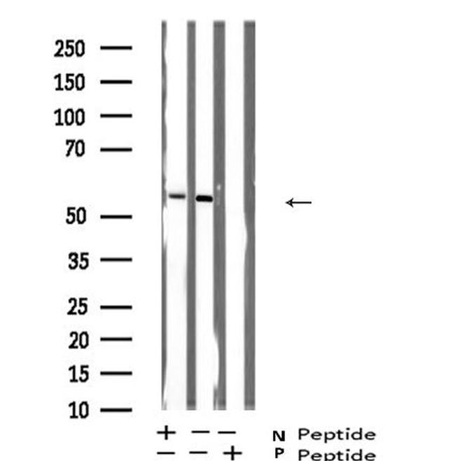 Phospho-LCK (Ser59) Antibody in Western Blot (WB)
