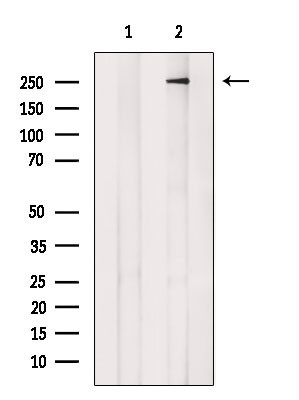 ARHGAP31 Antibody in Western Blot (WB)