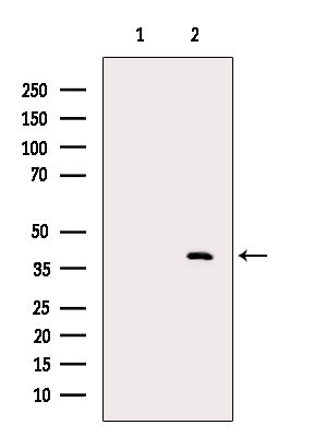 Nudel Antibody in Western Blot (WB)