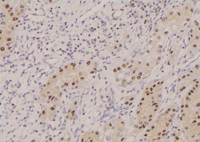 Phospho-KCNH2 (Ser1137) Antibody in Immunohistochemistry (Paraffin) (IHC (P))