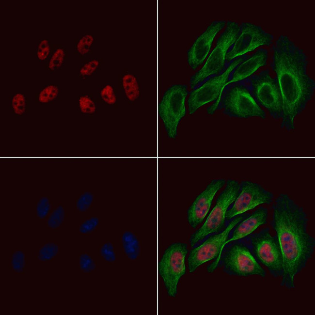 Phospho-KLF5 (Ser303) Antibody in Immunocytochemistry (ICC/IF)
