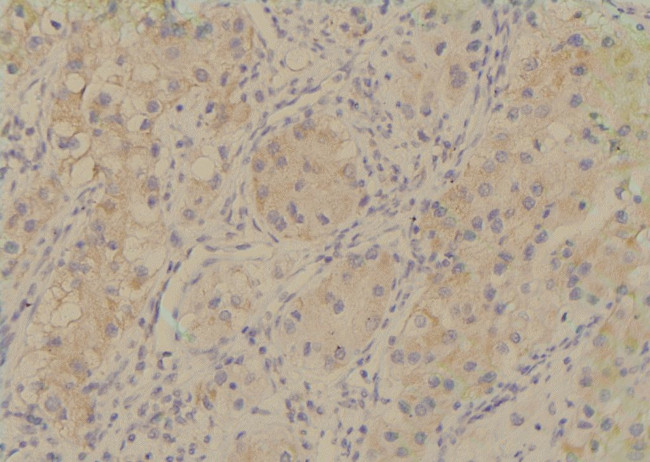 Phospho-TRAF7 (Ser61) Antibody in Immunohistochemistry (Paraffin) (IHC (P))