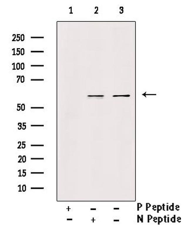 Phospho-VGAT (Ser462) Antibody in Western Blot (WB)