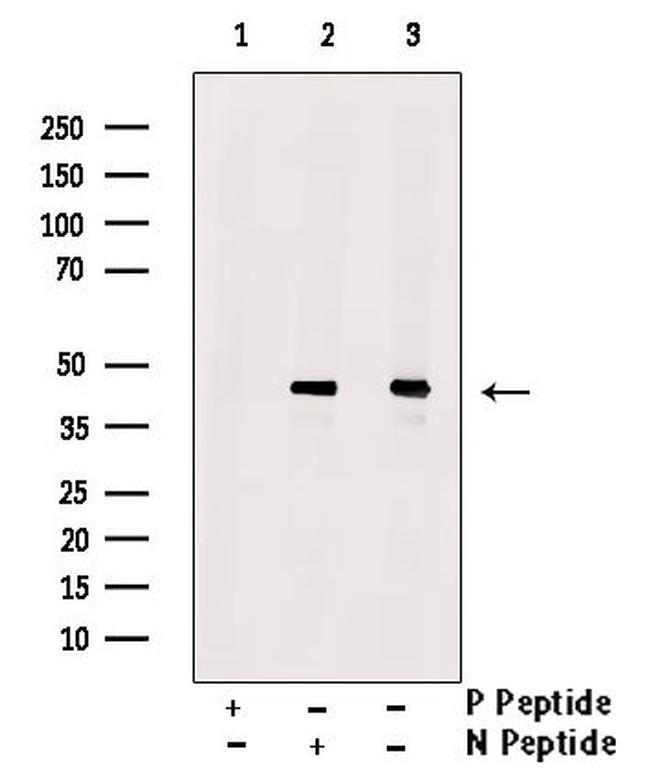 Phospho-SETD8 (Ser100) Antibody in Western Blot (WB)