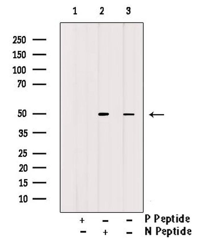 Phospho-eIF4A1 (Tyr48) Antibody in Western Blot (WB)